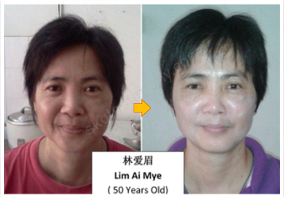 脱发减少，发质变好