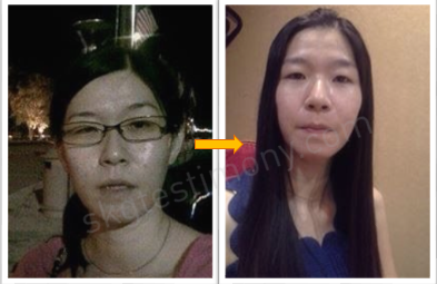 痘痘问题得到很大的改善+月事来临，不再是负担