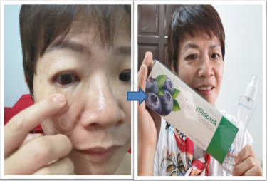 修复我的眼睛问题