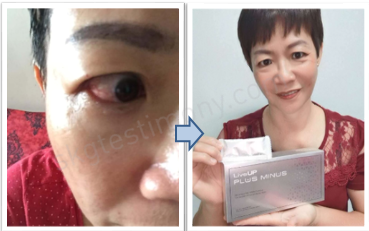 眼睛不敏感了