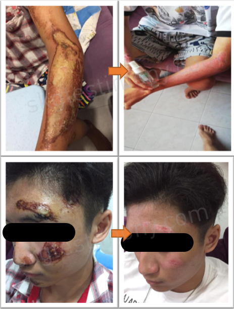 皮肤就已经恢复得7788了