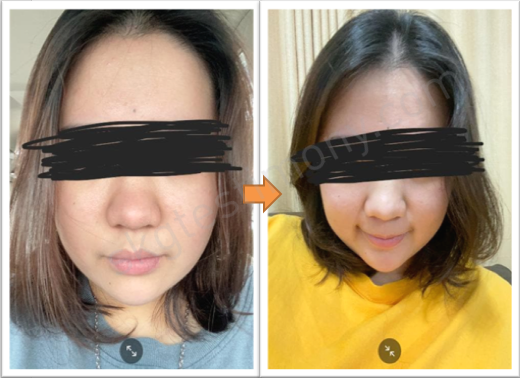不经痛、皮肤也变好