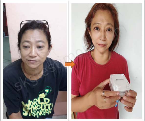 它抚平了我的皱纹