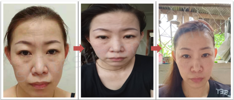 让我悄悄变美